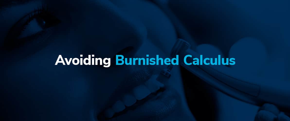 How to Avoid Burnished Calculus & Tips to Remove It ProDentUSA